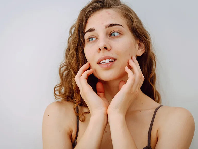 換季皮膚乾癢怎麼辦？從穩定肌膚屏障開始